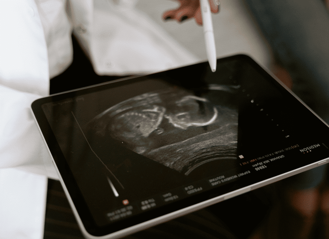 iPad displaying ultrasound